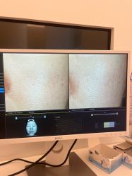 -苑苑vbeauty科技美容SPA