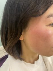 -长沙雅美医疗美容医院