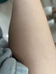 -中科妍美专业脱毛美肤连锁机构