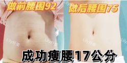 -Lily纤美·科技减脂中心