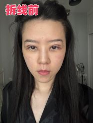 -素美医疗美容·西南眼鼻整形·修复基地