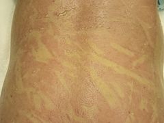 -华夏良子·足道SPA艾灸(铁道大厦店)