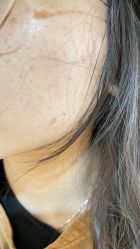 -广州美莱医疗美容医院