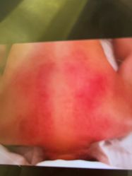 -苑苑vbeauty科技美容SPA