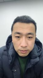 体验后-大麦微针植发丨全国连锁