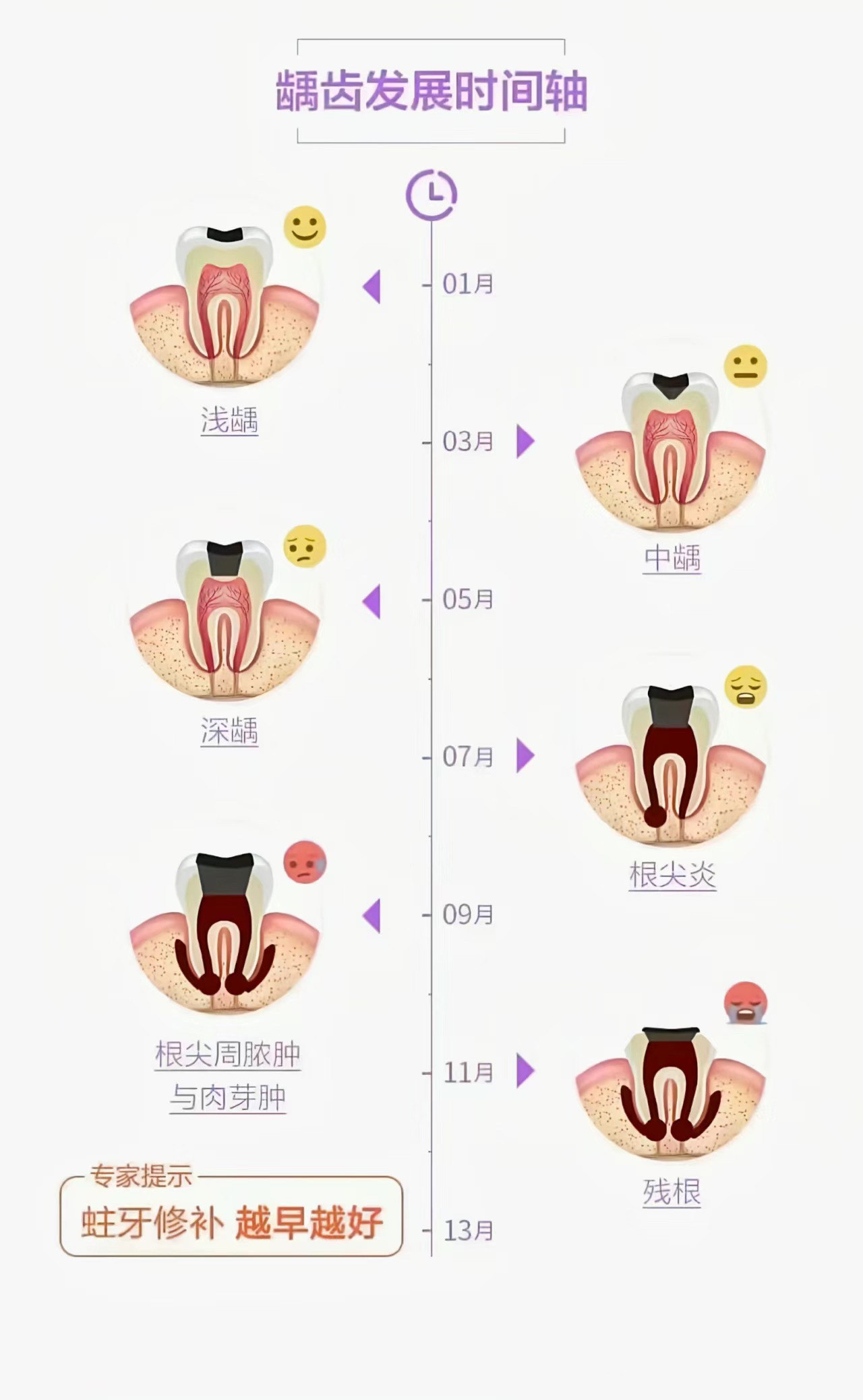 龋齿深浅程度判断图片图片