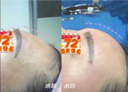 -圣嘉新医疗美容医院