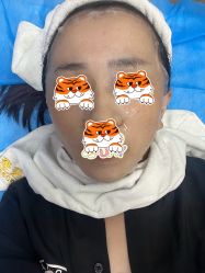 体验后-弘美医美·艾维岚童颜抗衰中心