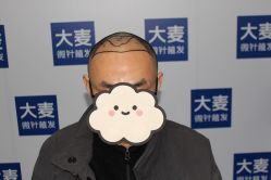 点击看大图 -大麦微针植发丨全国连锁