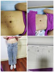 -清媚减肥瘦身纤体