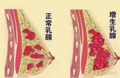 -蓝丝带催乳产后恢复中心(常熟万达店)