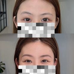 -Doris多里斯半永久纹眉·SMP纹发·发际线