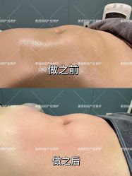 -美丽妈妈产后恢复中心(三林店)