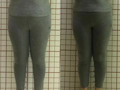 -修申骨雕小颜脊柱骨盆管理产后修复