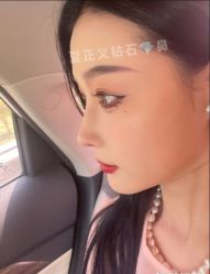 -北京米扬丽格医疗美容·联合丽格鼻整形中心