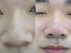 -蕾特恩专业祛痘·皮肤管理