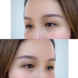 点击看大图 -Doris多里斯半永久纹眉·SMP纹发·发际线