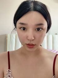 -成都西区医院整形美容