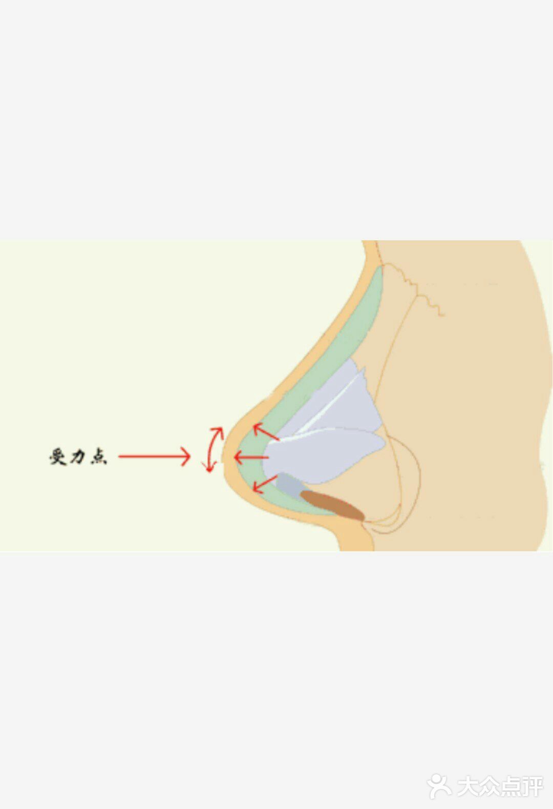 行业内的㊙密，你是否被伪鼻综合迷惑❗❗