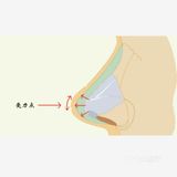 行业内的㊙密，你是否被伪鼻综合迷惑❗❗