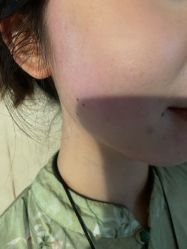 -四川米兰柏羽医学美容医院