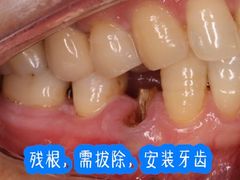 -团圆口腔·种植中心(锦江院区)