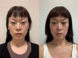 -郑荃丽格医疗美容