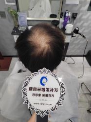 -唐风采假发补发定制
