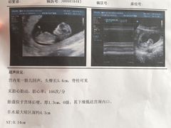 -西安曲江妇产医院-妇科