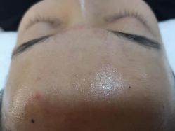 -skin79皮肤管理基站