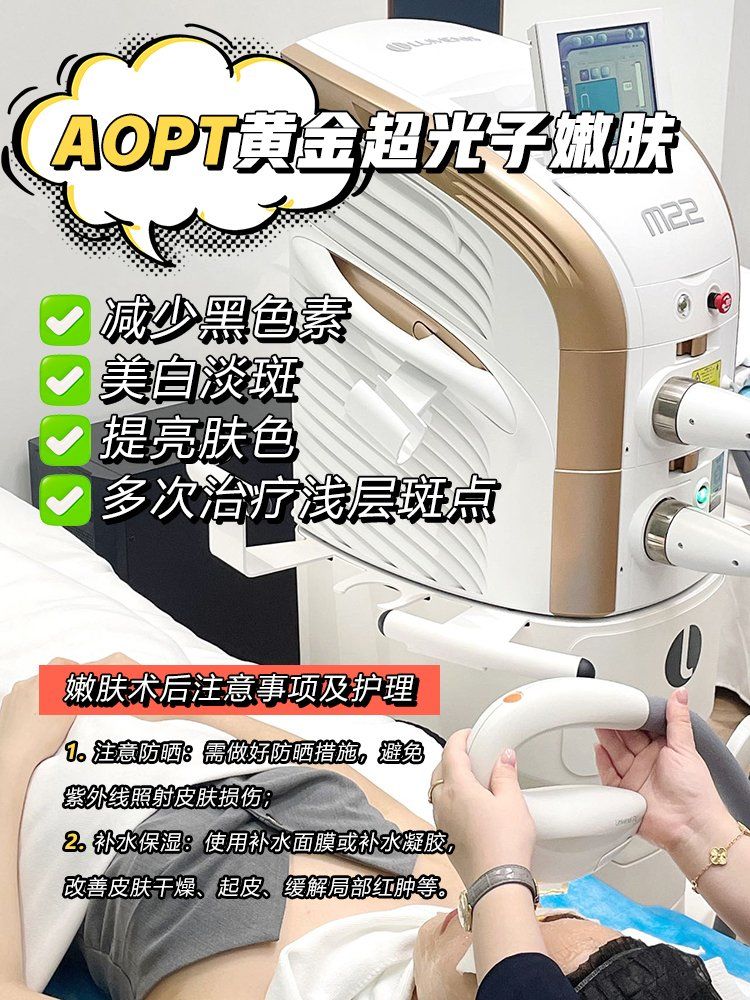 aopt黄金超光子嫩肤仪器