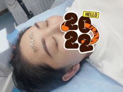 体验后-郡艺医疗美容·微整·眼鼻吸脂