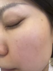 -长沙雅美医疗美容医院