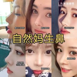 -北京米扬丽格医疗美容·联合丽格鼻整形中心