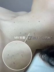 -+MS卓美丝专业祛痘·皮肤管理中心