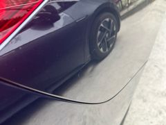 -鲨鱼皮汽车凹陷玻璃修复(静安店)