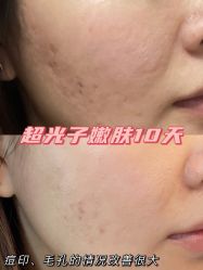 -Yestar宁波艺星整形医院