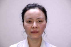 -北京叶子整形美容医院