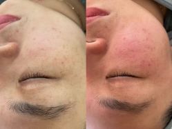 -skin79皮肤管理中心