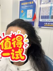-大麦微针植发全国连锁