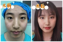 -素美医疗美容·西南眼鼻整形·修复基地