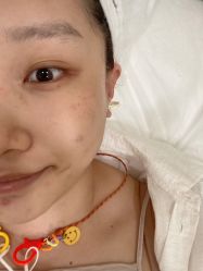 体验前-海涛医疗美容·面部抗衰·注射美鼻