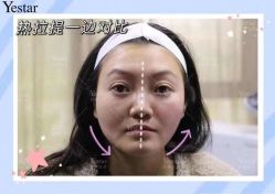 -Yestar艺星医疗美容医院