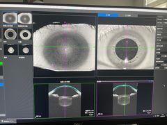 -山东中医药大学附属眼科医院