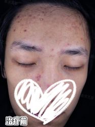 -Yestar重庆艺星医疗美容医院