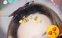 -大麦微针植发全国连锁