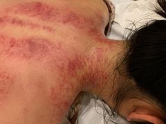 -艾之灸养生馆·推拿·艾灸