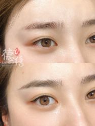 -德绣·机器野生眉发际线·美瞳线半永久