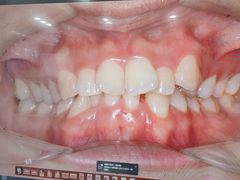 -同步齿科·数字化正畸种植口腔中心(珠海店)