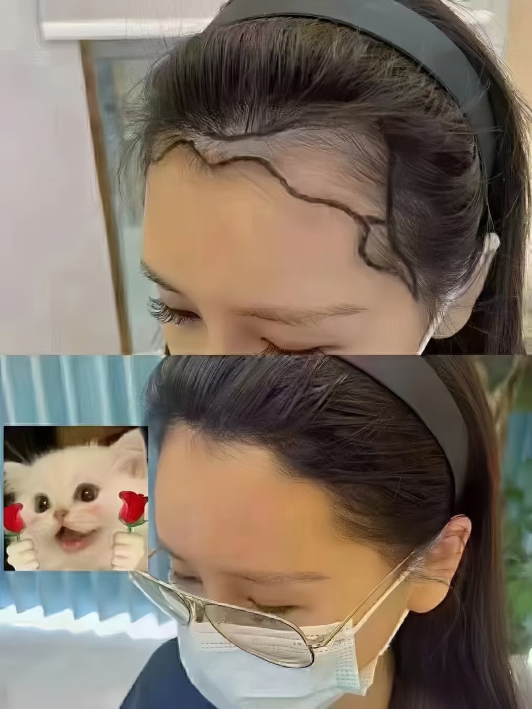 蓬松点植发(蓬松的发质做什么发型好看)